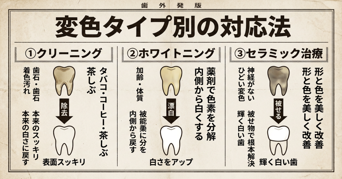 前歯1本だけが変色する4つの原因タイプと見分け方