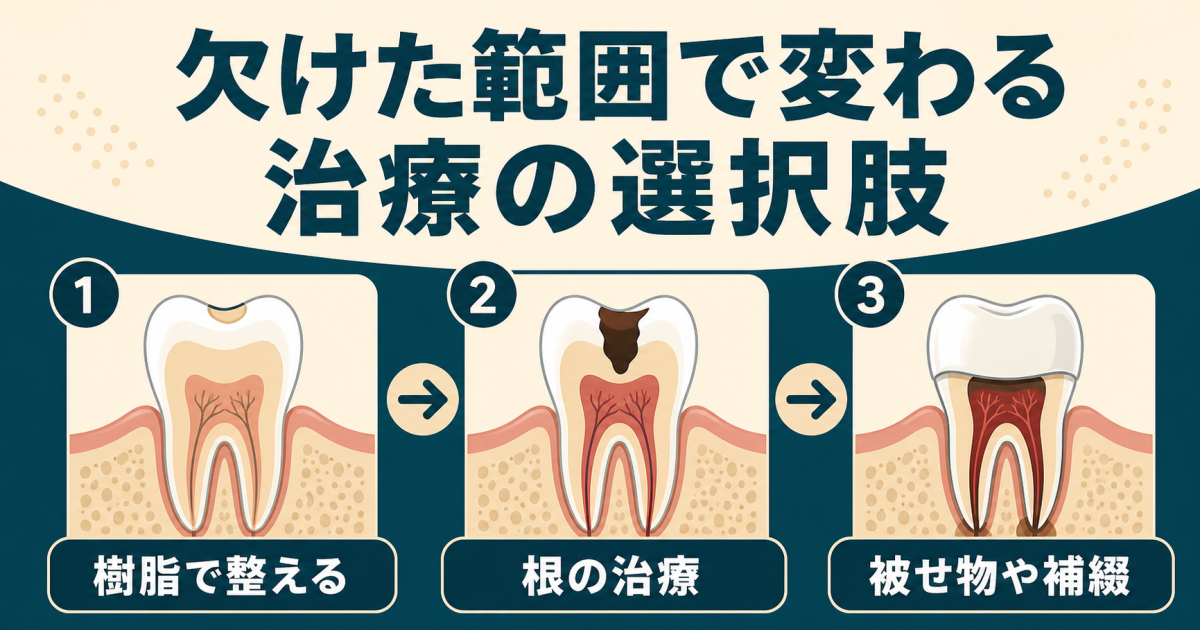 欠けた範囲別の治療選択肢と費用・保険適用の目安