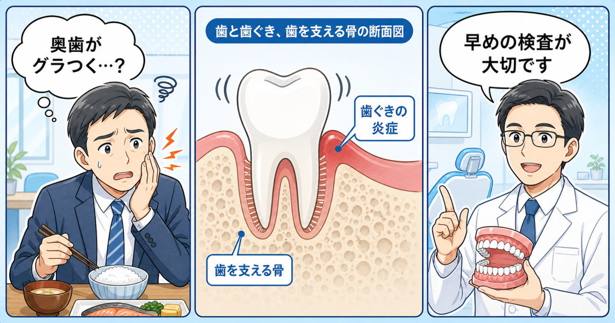 歯のグラグラは抜ける前兆？歯周病で歯を残すためのチェックと受診の目安