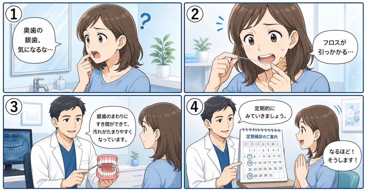 銀歯をセラミックに替えるタイミング｜痛くないのに交換が必要な理由