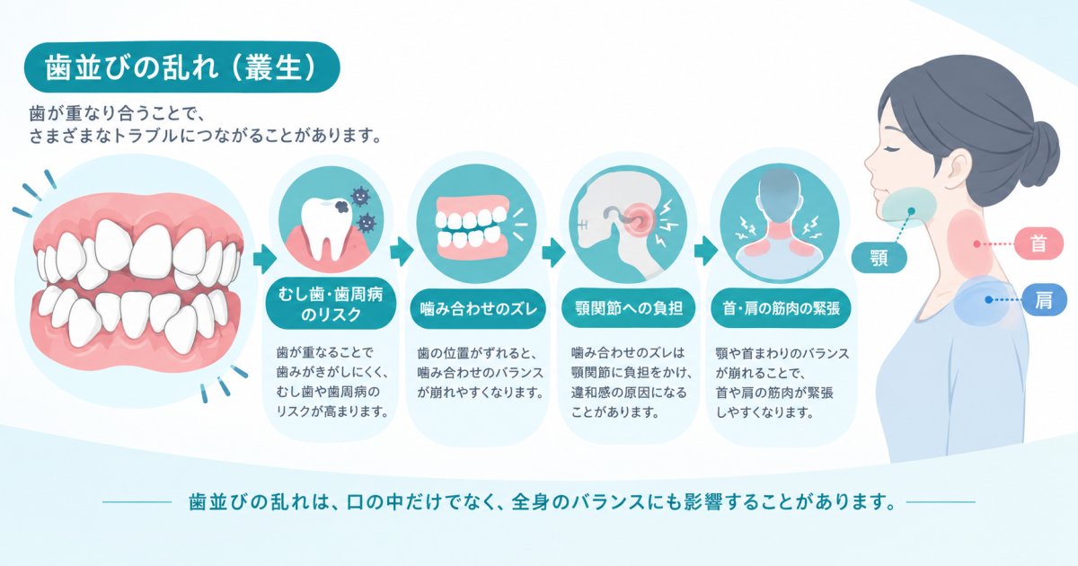 長年放置してきた歯並び、悪化の過程と肩こり・頭痛との関係