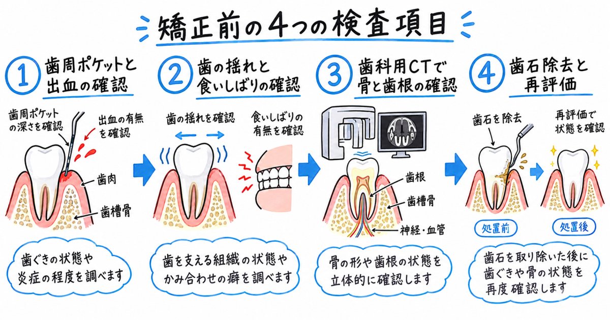 矯正前に歯ぐきと骨を確かめる検査項目と、歯周病治療を優先する判断基準
